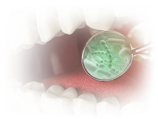 gum-disease-graphic